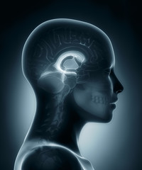 Ventricles medical x-ray scan