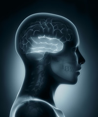 Temporal lobe medical x-ray scan