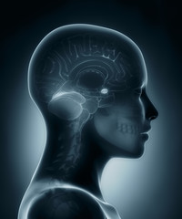 Amygdala medical x-ray scan