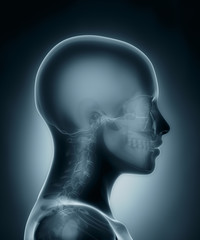 Skull medical x-ray scan