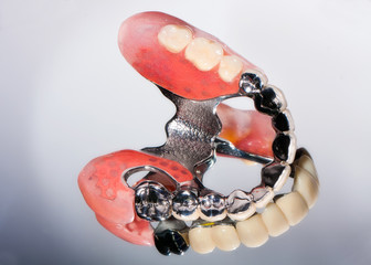 Dental prosthesis