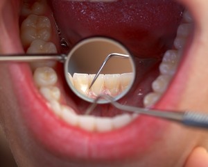 Extensive dental examination