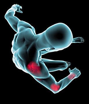 Uomo caduta dolore polso gomito spalla