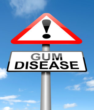 Gum Disease Concept.