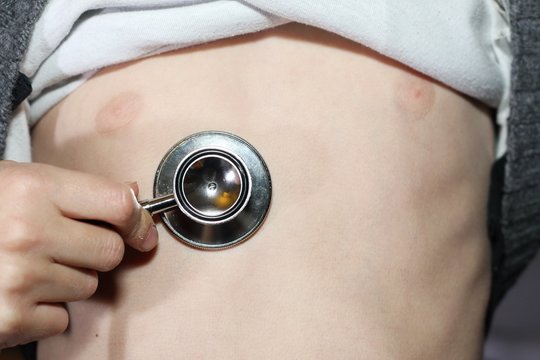 medical stethoscope resting on the chest of a young child with p