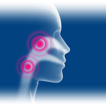 Atemwege Entz&uuml;ndung - 3D Illustration