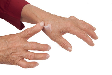 Fototapeta premium Old Woman's Hands Deformed From Rheumatoid Arthritis