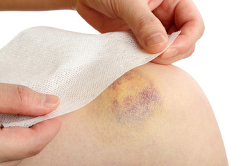Preparing a bandage wrapped on injured knee