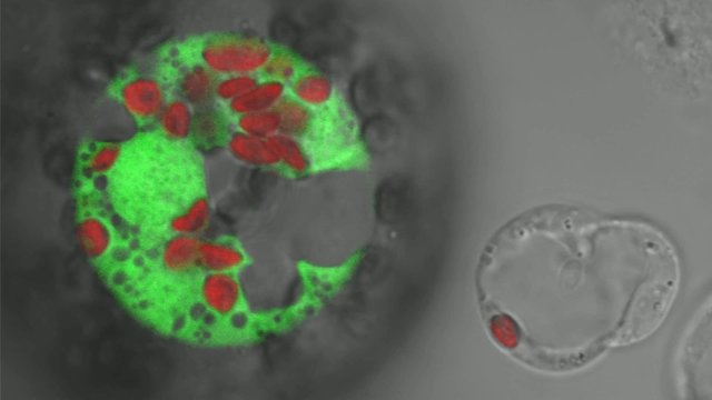 Movement of organelles in tobacco protoplasts