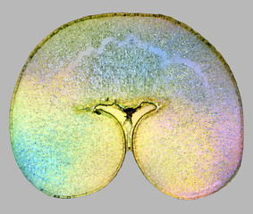 Potato strarch grain