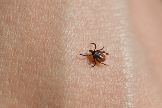 Ixodes Scapularis