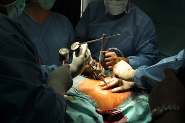 Prosthesis of the hip hospital operation