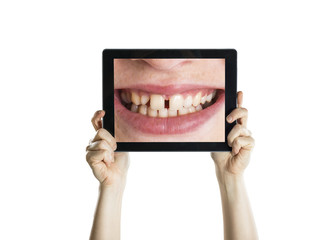 Dental closeup with tablet
