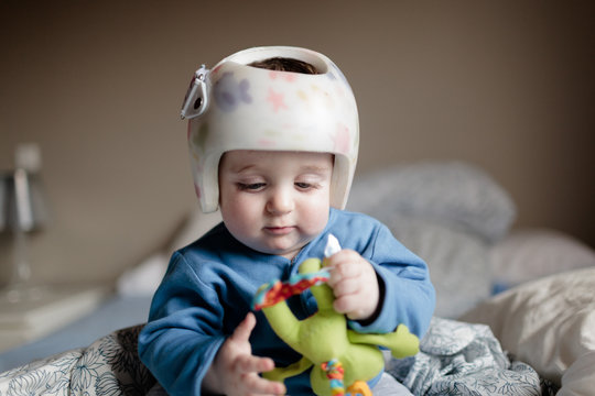 Plagiocephaly Images – Browse 244 Stock Photos, Vectors, and Video | Adobe Stock