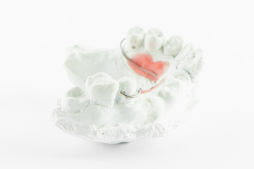 wire in Plaster denture model