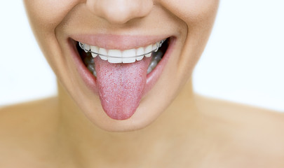 girl with retainer for teeth sticking her tongue out