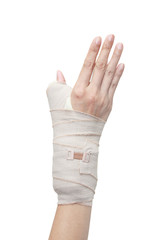 broken woman arm in a cast