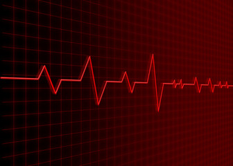 Electrocardiogram, ecg, graph, pulse tracing 