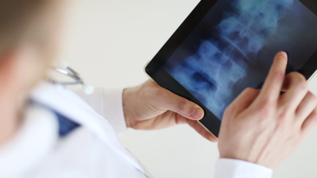 doctor working with x-ray scan on tablet pc