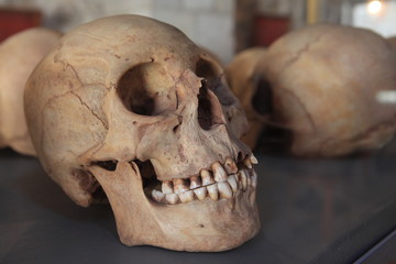 Totenkopf