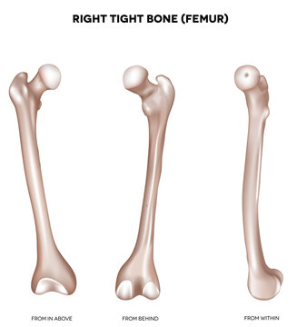 Tight bone- Femur