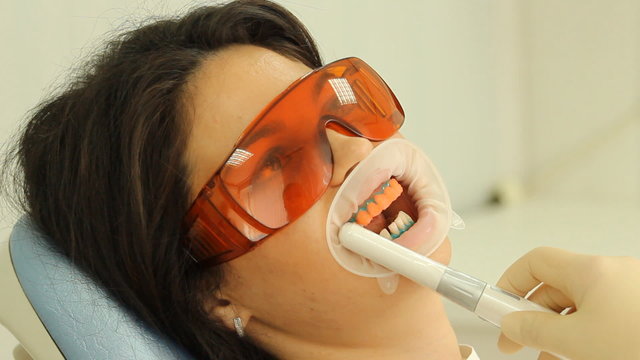 Teeth Whitening. Activation of the gel polymerization light. 