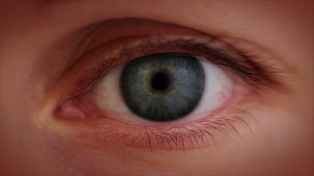 The aging eye. Close-up