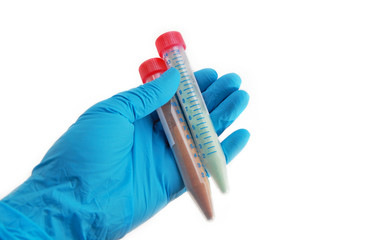arm in glove holds tubes with chemical compounds