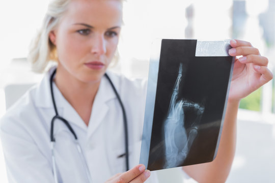 Serious nurse holding an x-ray