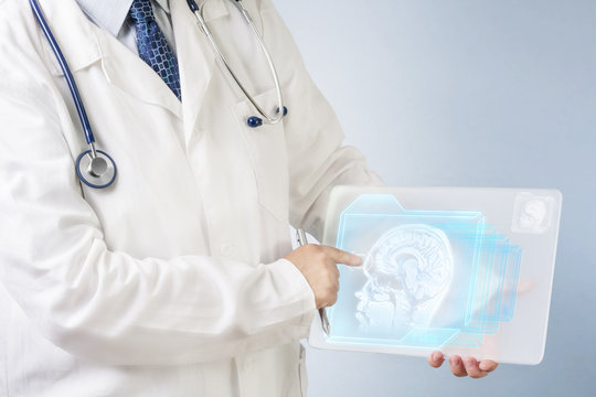 Doctor analyzing brain image