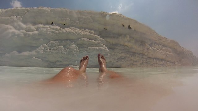 Mans lags in calcium bath, Pamukkale
