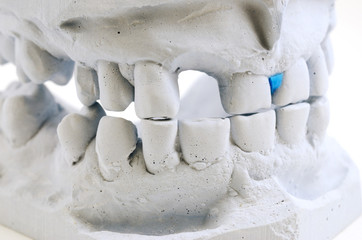 detailed macro of teeth molding