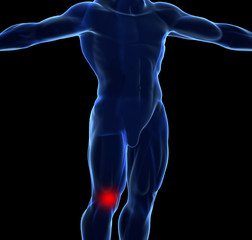Knee Pain concept