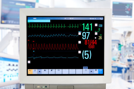 Electrocardiogram monitor