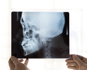 X-ray picture - obrazy, fototapety, plakaty