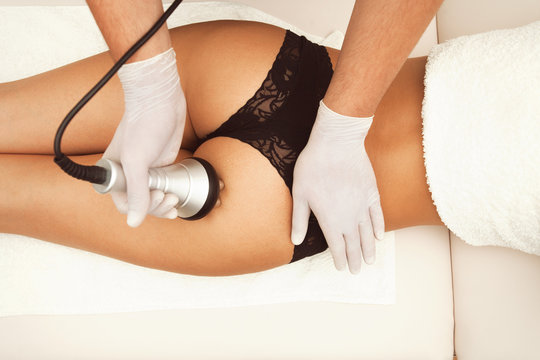 Cellulite Treatment