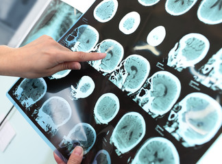 Doctor examines the patient tomogram