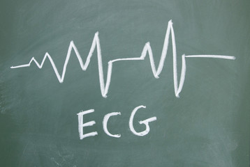 ECG sign