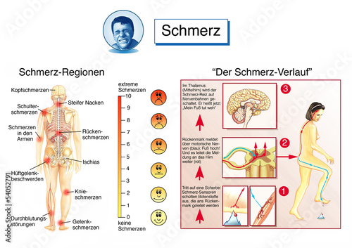 Schmerzen In Armen Und Beinen Psychosomatisch