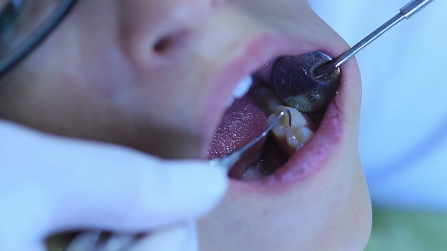 Dentist - Close-up of patient (young girl) open mouth during ora