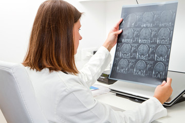 medico esamina una radiografia - obrazy, fototapety, plakaty