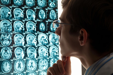 Man doctor looking at x-ray