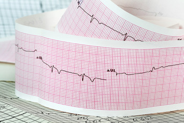 Cardiogram the concept for strokes and heart attacks