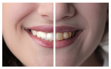 dental health