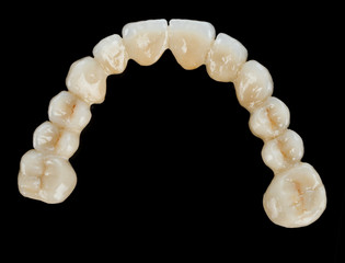 Porcelain teeth - dental bridge