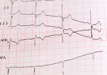 Naklejka premium cardiogram