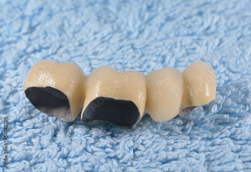 "Zahnersatz: Keramikbrücke im Rohzustand" Stockfotos und lizenzfreie