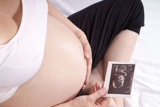 schwangere Frau mit Ultraschallbild