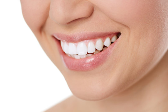 Perfect smile of young woman after teeth whitening, isolated