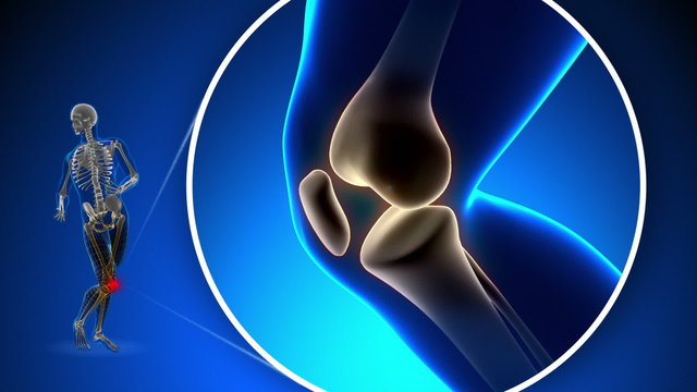 Pain in Knee - Xray concept on blue background